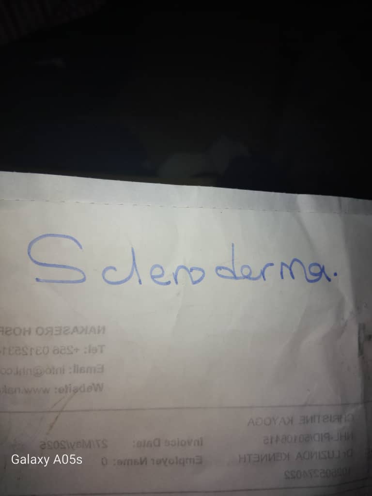 Urgent Request for Support – Assistance for Scleroderma Patient